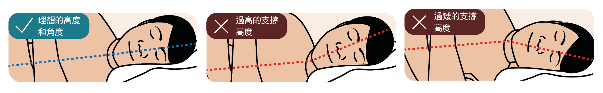 圖4:側臥的頭部角度