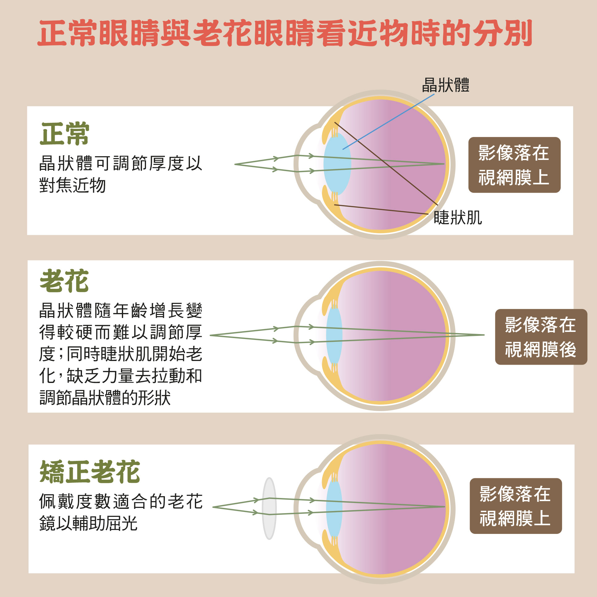 老花的成因